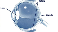 recovery from torn retina surgery